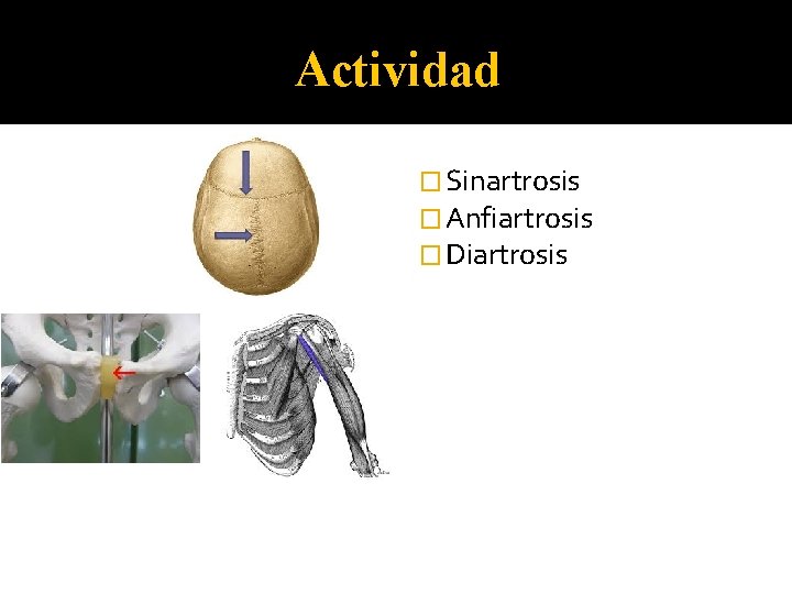 Actividad � Sinartrosis � Anfiartrosis � Diartrosis 