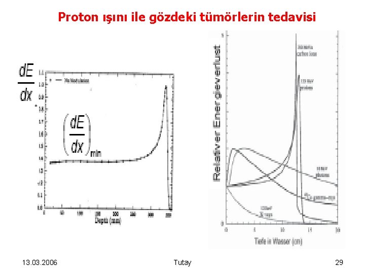 Proton ışını ile gözdeki tümörlerin tedavisi 13. 03. 2006 Tutay 29 