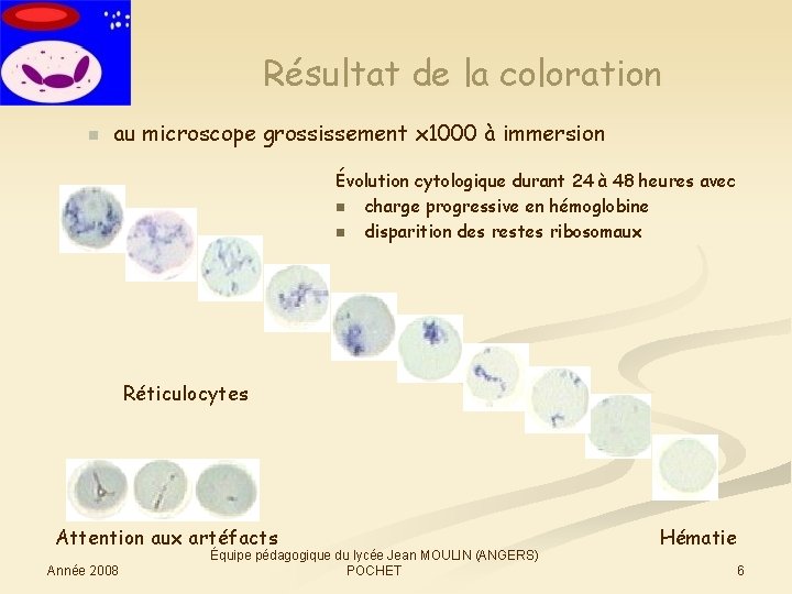 Résultat de la coloration n au microscope grossissement x 1000 à immersion Évolution cytologique