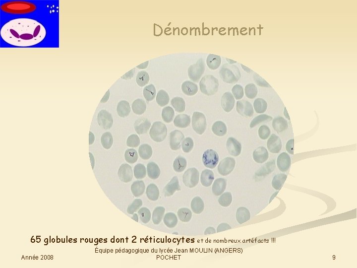 Dénombrement 65 globules rouges dont 2 réticulocytes Année 2008 et de nombreux artéfacts !!!