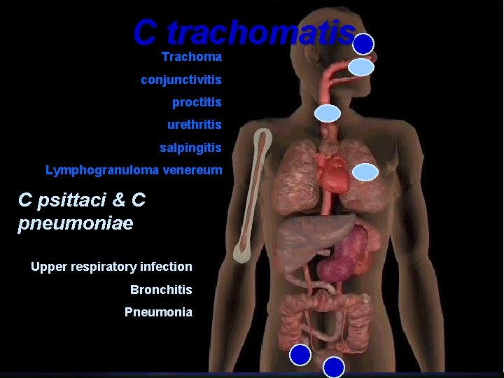 C trachomatis Trachoma conjunctivitis proctitis urethritis salpingitis Lymphogranuloma venereum C psittaci & C pneumoniae