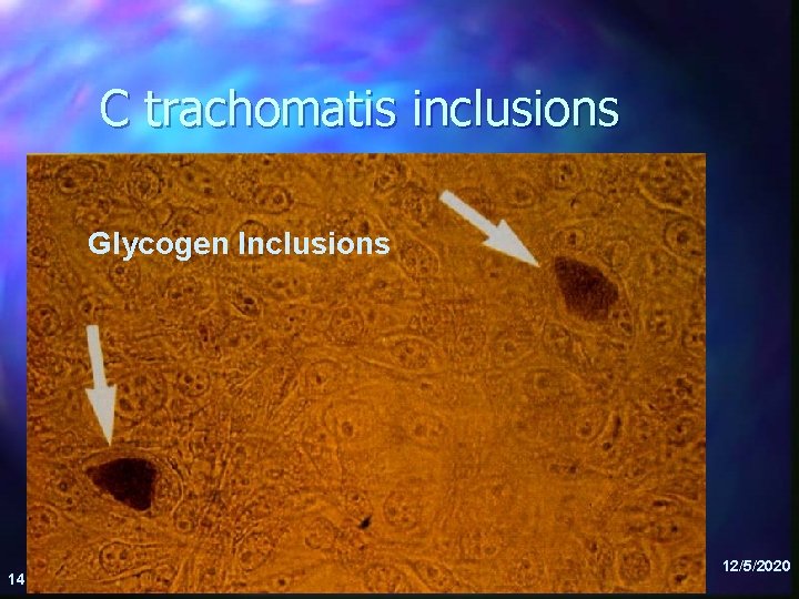 C trachomatis inclusions Glycogen Inclusions 14 12/5/2020 