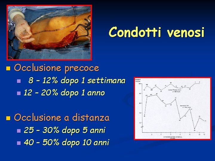 Condotti venosi n Occlusione precoce 8 – 12% dopo 1 settimana n 12 –