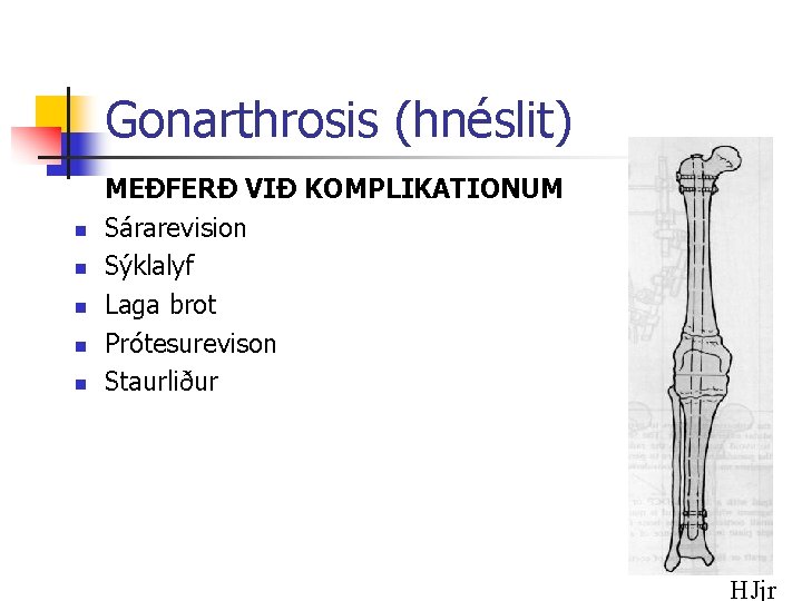 Gonarthrosis (hnéslit) n n n MEÐFERÐ VIÐ KOMPLIKATIONUM Sárarevision Sýklalyf Laga brot Prótesurevison Staurliður