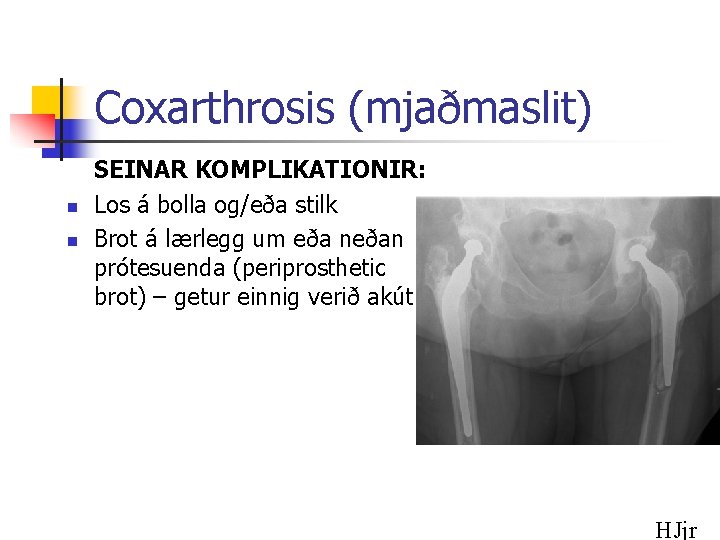 Coxarthrosis (mjaðmaslit) n n SEINAR KOMPLIKATIONIR: Los á bolla og/eða stilk Brot á lærlegg