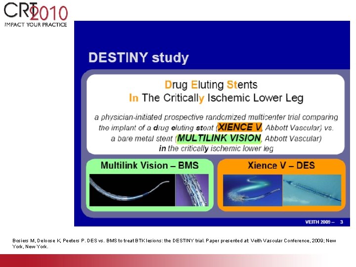 Bosiers M, Deloose K, Peeters P. DES vs. BMS to treat BTK lesions: the Bosiers M, Deloose K, Peeters P. DES vs. BMS to treat BTK lesions: the