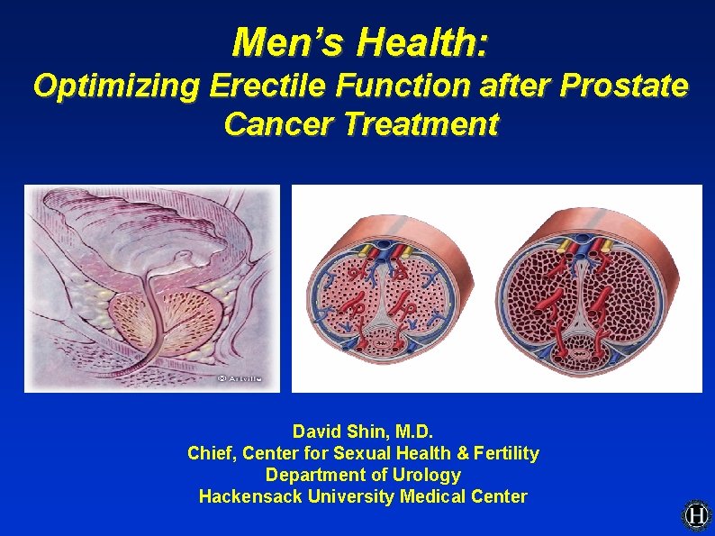 Men’s Health: Optimizing Erectile Function after Prostate Cancer Treatment David Shin, M. D. Chief, Men’s Health: Optimizing Erectile Function after Prostate Cancer Treatment David Shin, M. D. Chief,