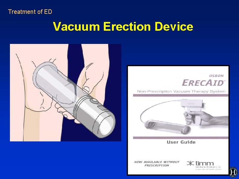 Treatment of ED Vacuum Erection Device Treatment of ED Vacuum Erection Device