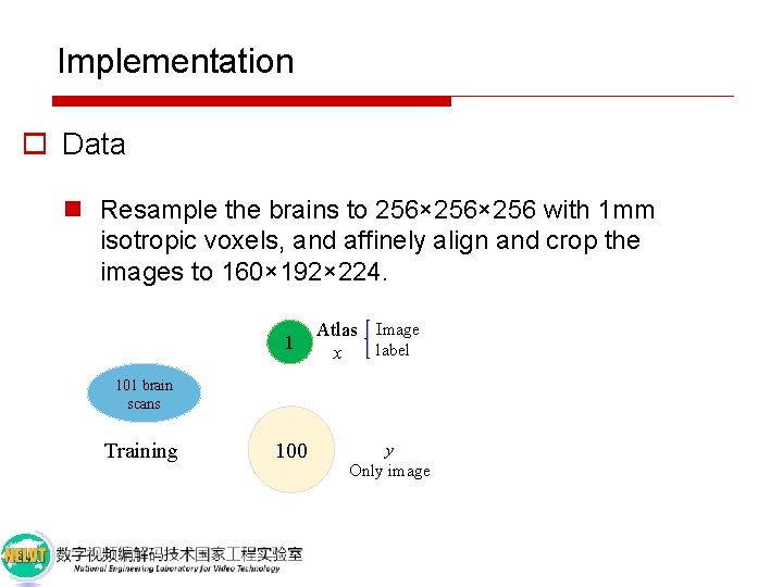 Implementation o Data n Resample the brains to 256× 256 with 1 mm isotropic