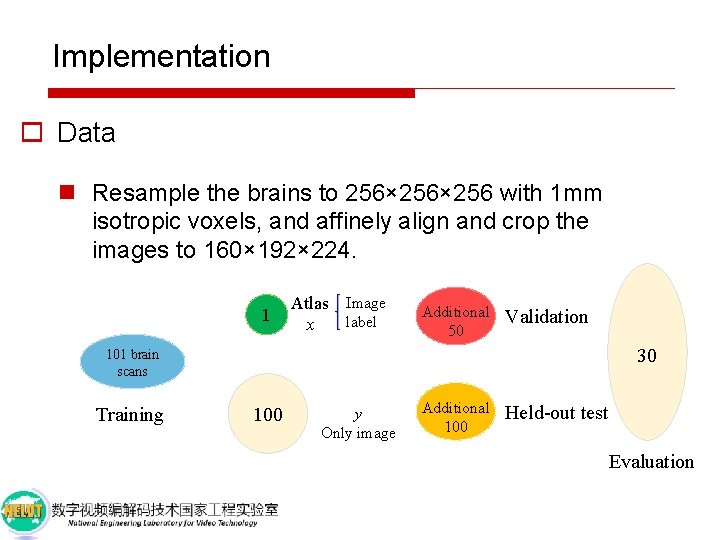 Implementation o Data n Resample the brains to 256× 256 with 1 mm isotropic