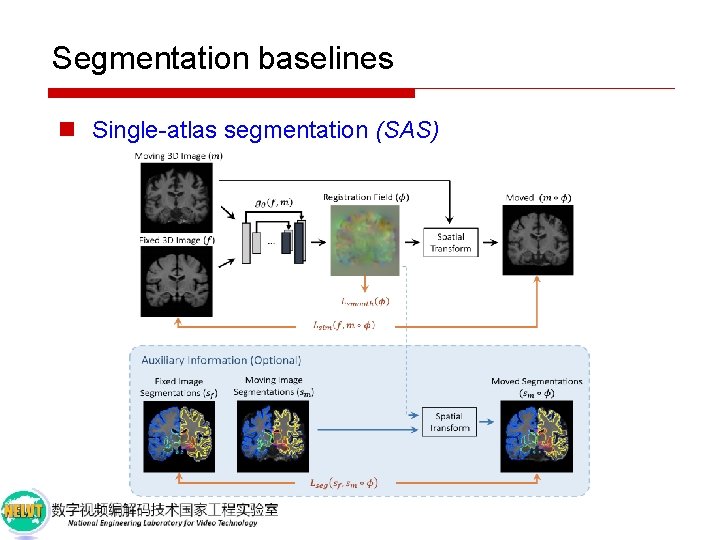 Segmentation baselines n Single-atlas segmentation (SAS) 