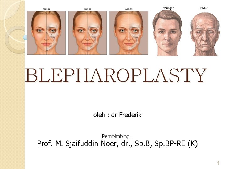 BLEPHAROPLASTY oleh : dr Frederik Pembimbing : Prof. M. Sjaifuddin Noer, dr. , Sp.