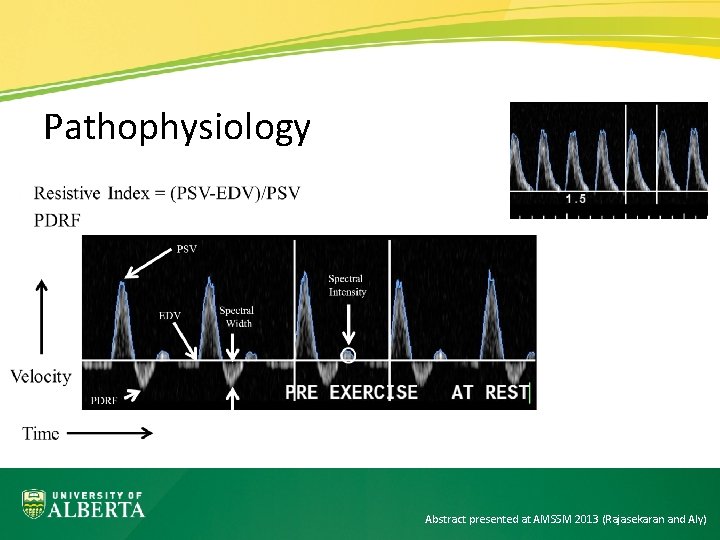 Pathophysiology Abstract presented at AMSSM 2013 (Rajasekaran and Aly) 