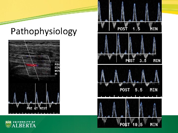 Pathophysiology 