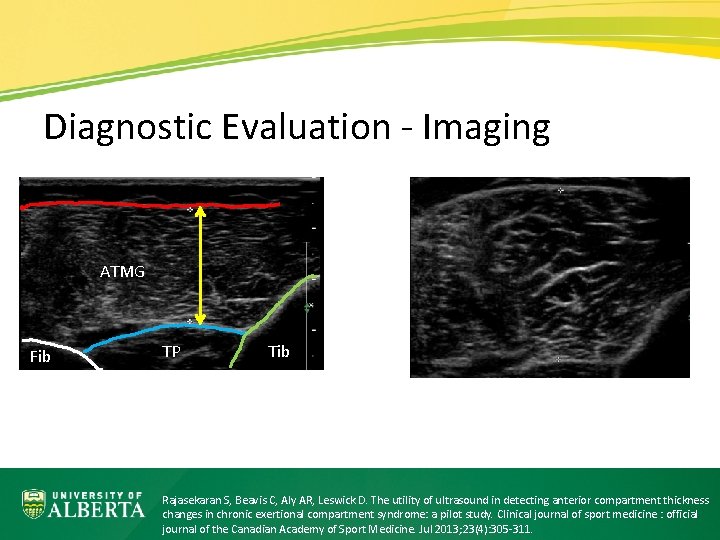 Diagnostic Evaluation - Imaging ATMG Fib TP Tib Rajasekaran S, Beavis C, Aly AR,
