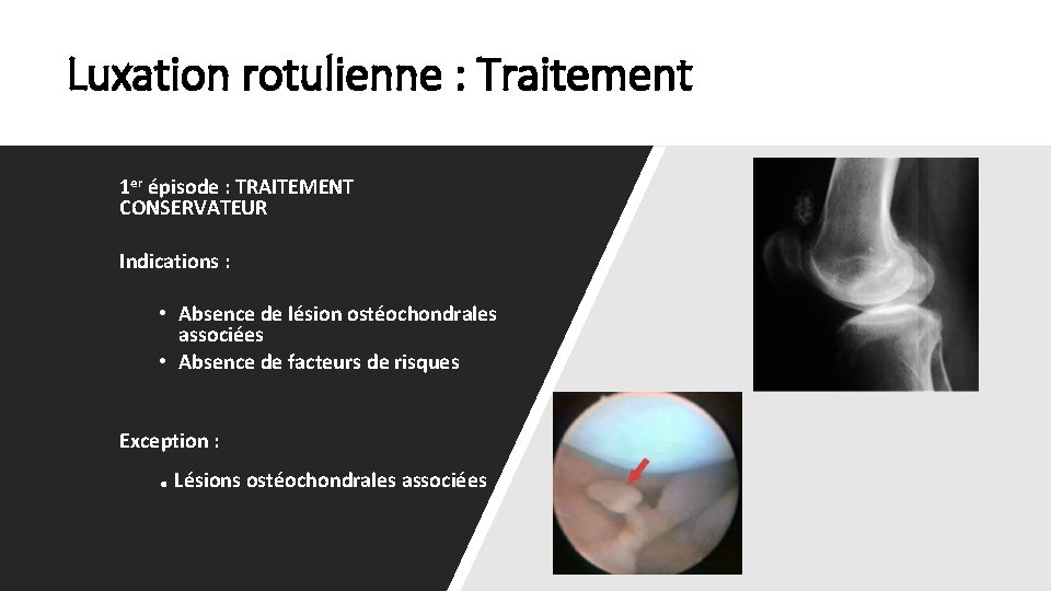 Luxation rotulienne : Traitement 1 er épisode : TRAITEMENT CONSERVATEUR Indications : • Absence