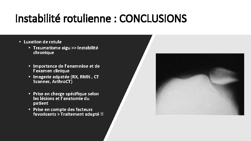 Instabilité rotulienne : CONCLUSIONS • Luxation de rotule • Traumatisme aigu >> Instabilité chronique