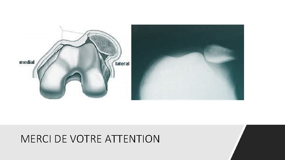 MERCI DE VOTRE ATTENTION 