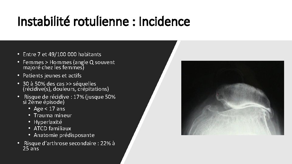 Instabilité rotulienne : Incidence • Entre 7 et 49/100 000 habitants • Femmes >
