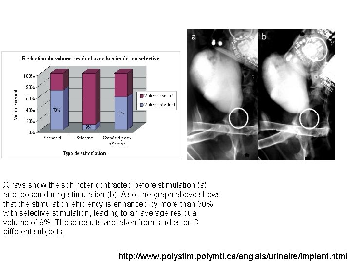X-rays show the sphincter contracted before stimulation (a) and loosen during stimulation (b). Also,