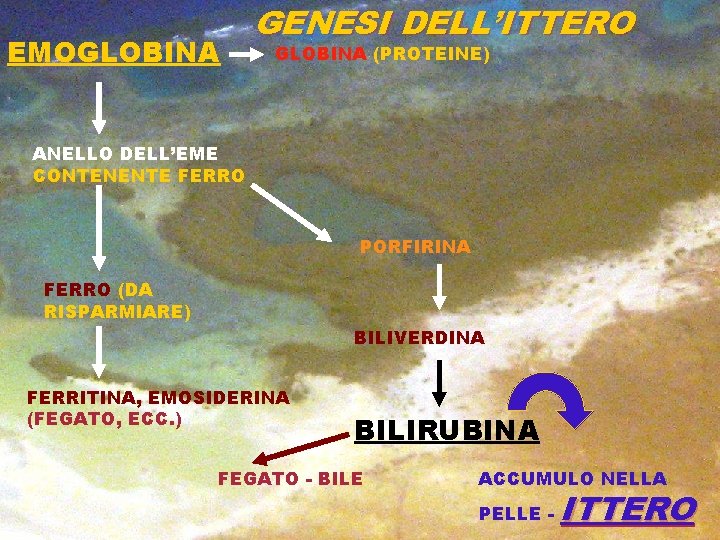 EMOGLOBINA GENESI DELL’ITTERO GLOBINA (PROTEINE) ANELLO DELL’EME CONTENENTE FERRO PORFIRINA FERRO (DA RISPARMIARE) BILIVERDINA
