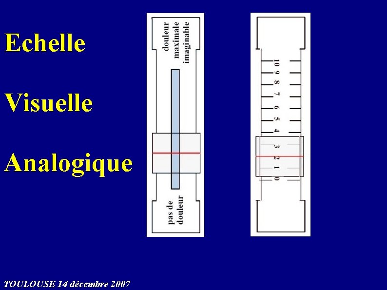 Echelle Visuelle Analogique TOULOUSE 14 décembre 2007 