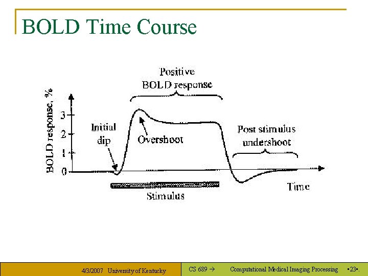 BOLD Time Course 4/3/2007 University of Kentucky CS 689 Computational Medical Imaging Processing •