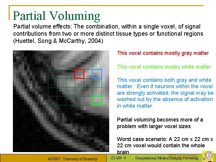 Partial Voluming Partial volume effects: The combination, within a single voxel, of signal contributions