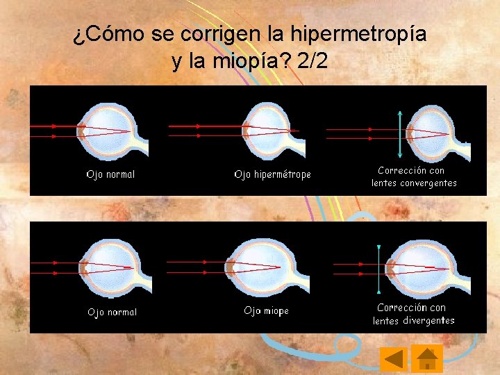 ¿Cómo se corrigen la hipermetropía y la miopía? 2/2 