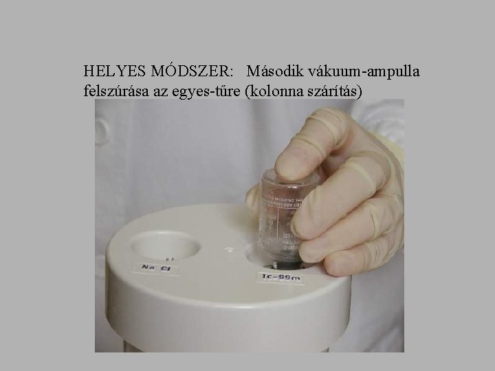 HELYES MÓDSZER: Második vákuum-ampulla felszúrása az egyes-tűre (kolonna szárítás) 