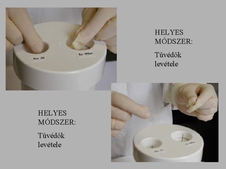 HELYES MÓDSZER: Tűvédők levétele 