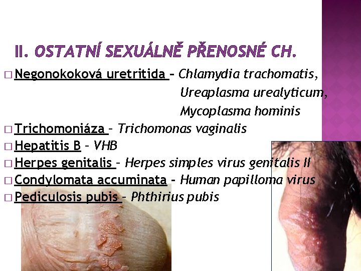 II. OSTATNÍ SEXUÁLNĚ PŘENOSNÉ CH. � Negonokoková uretritida – Chlamydia trachomatis, Ureaplasma urealyticum, Mycoplasma