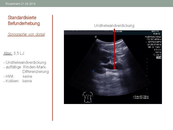 Rosenheim 21. 04. 2018 Standardisierte Befunderhebung Sonographie von dorsal Alter: 3, 5 LJ -