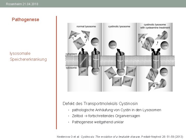 Rosenheim 21. 04. 2018 Pathogenese lysosomale Speichererkrankung Defekt des Transportmoleküls Cystinosin • pathologische Anhäufung