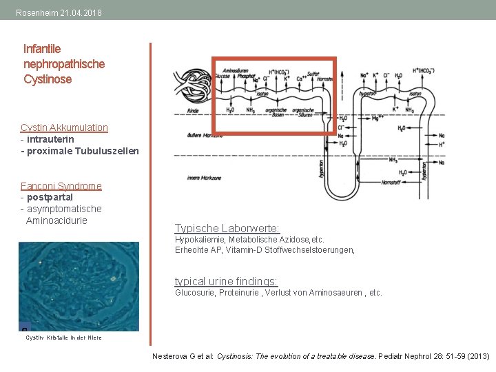 Rosenheim 21. 04. 2018 Infantile nephropathische Cystinose Cystin Akkumulation - intrauterin - proximale Tubuluszellen