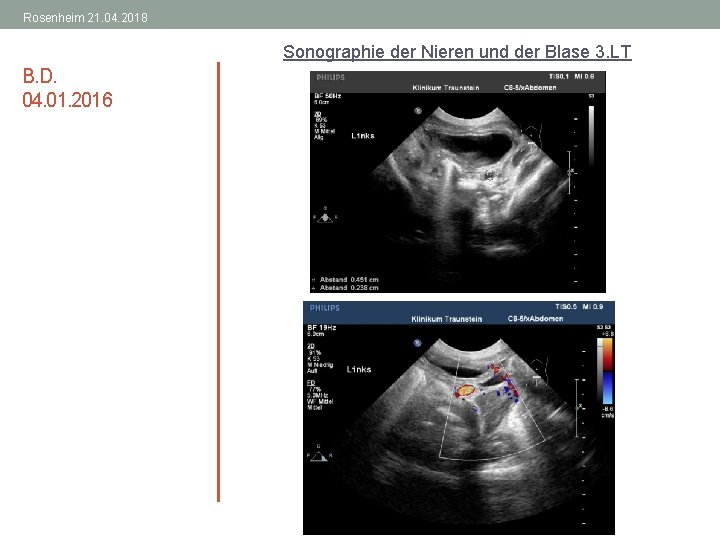 Rosenheim 21. 04. 2018 Sonographie der Nieren und der Blase 3. LT B. D.