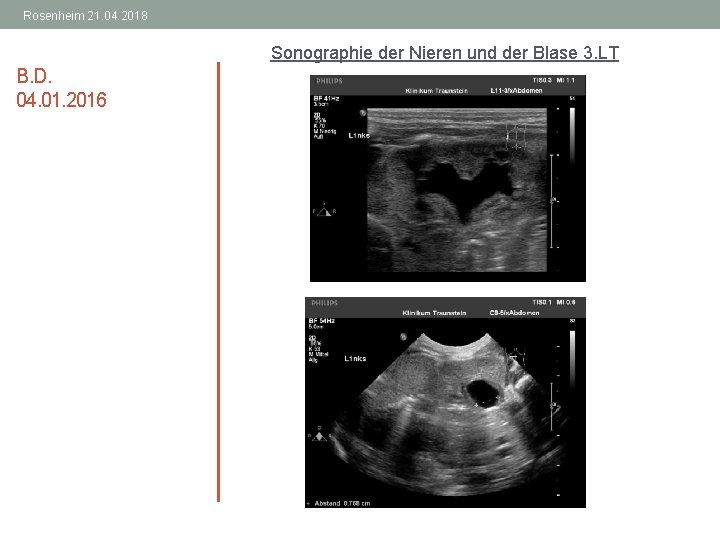 Rosenheim 21. 04. 2018 Sonographie der Nieren und der Blase 3. LT B. D.