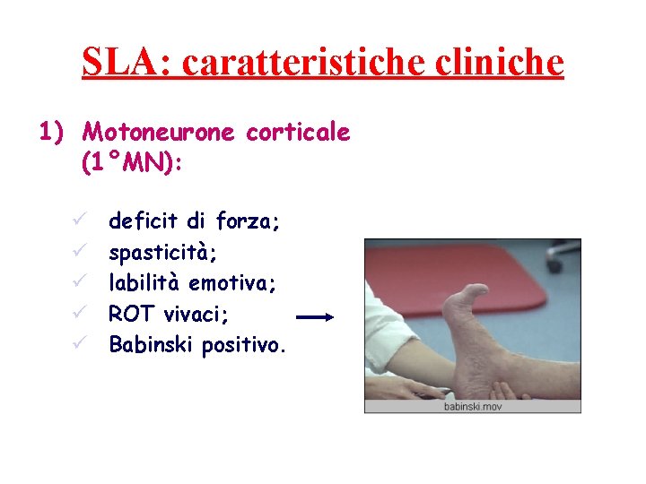 SLA: caratteristiche cliniche 1) Motoneurone corticale (1°MN): ü ü ü deficit di forza; spasticità;