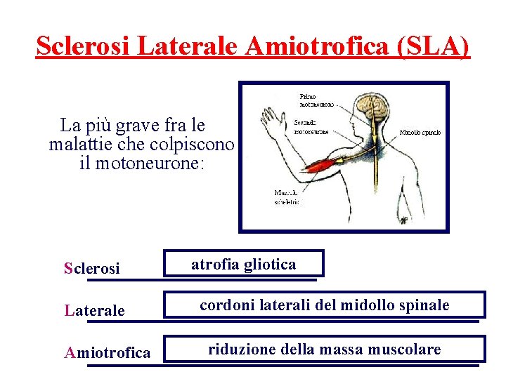 Sclerosi Laterale Amiotrofica (SLA) La più grave fra le malattie che colpiscono il motoneurone: