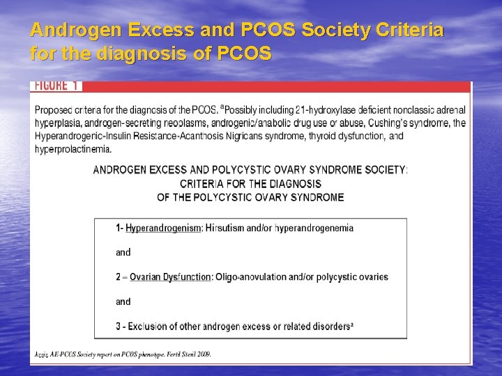 Androgen Excess and PCOS Society Criteria for the diagnosis of PCOS 