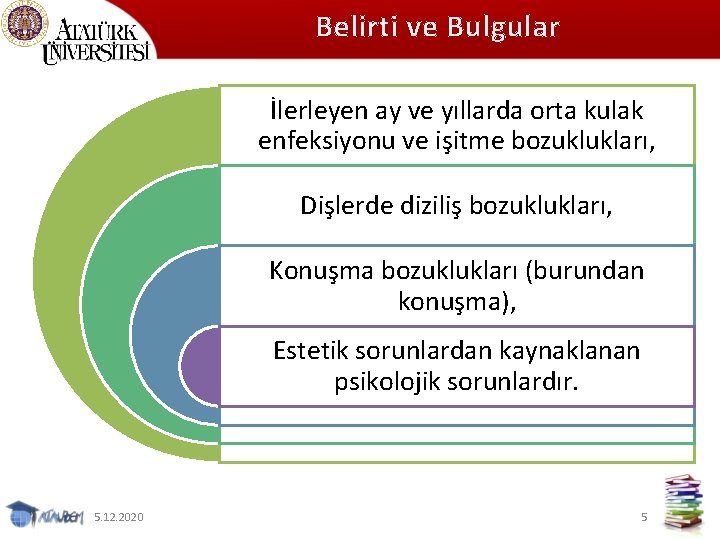 Belirti ve Bulgular İlerleyen ay ve yıllarda orta kulak enfeksiyonu ve işitme bozuklukları, Dişlerde