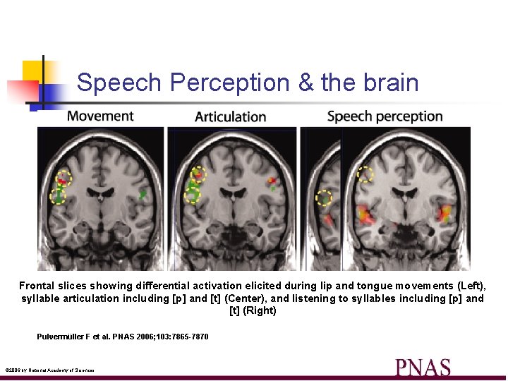 Speech Perception & the brain Frontal slices showing differential activation elicited during lip and