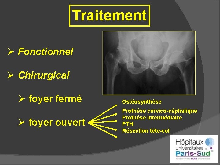 Traitement Ø Fonctionnel Ø Chirurgical Ø foyer fermé Ø foyer ouvert Ostéosynthèse Prothèse cervico-céphalique