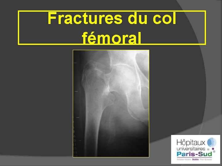 Fractures du col fémoral 