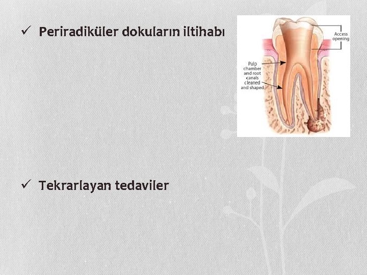 ü Periradiküler dokuların iltihabı ü Tekrarlayan tedaviler 