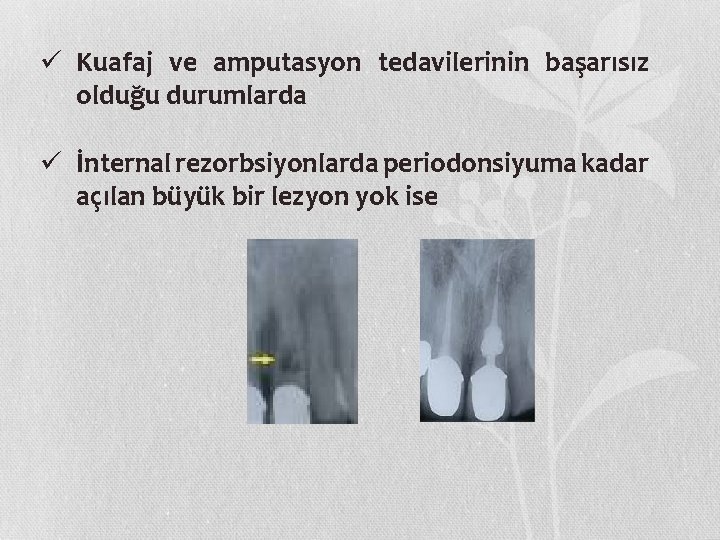 ü Kuafaj ve amputasyon tedavilerinin başarısız olduğu durumlarda ü İnternal rezorbsiyonlarda periodonsiyuma kadar açılan