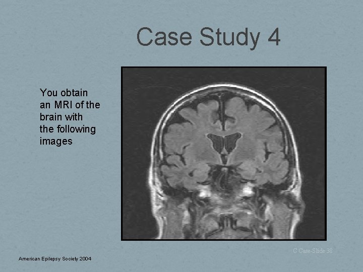 Case Study 4 You obtain an MRI of the brain with the following images
