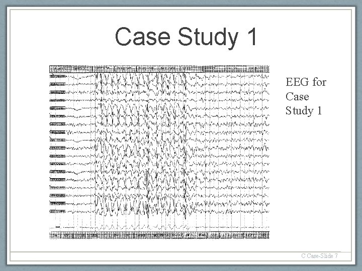 Case Study 1 EEG for Case Study 1 C Case-Slide 7 