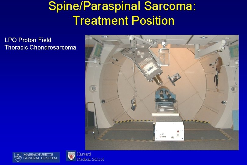 Spine/Paraspinal Sarcoma: Treatment Position LPO Proton Field Thoracic Chondrosarcoma Harvard Medical School 