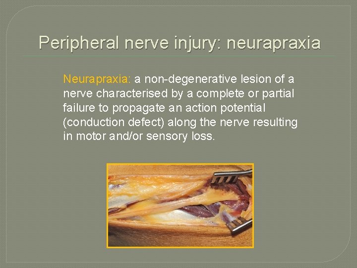 Peripheral nerve injury: neurapraxia Neurapraxia: a non-degenerative lesion of a nerve characterised by a Peripheral nerve injury: neurapraxia Neurapraxia: a non-degenerative lesion of a nerve characterised by a